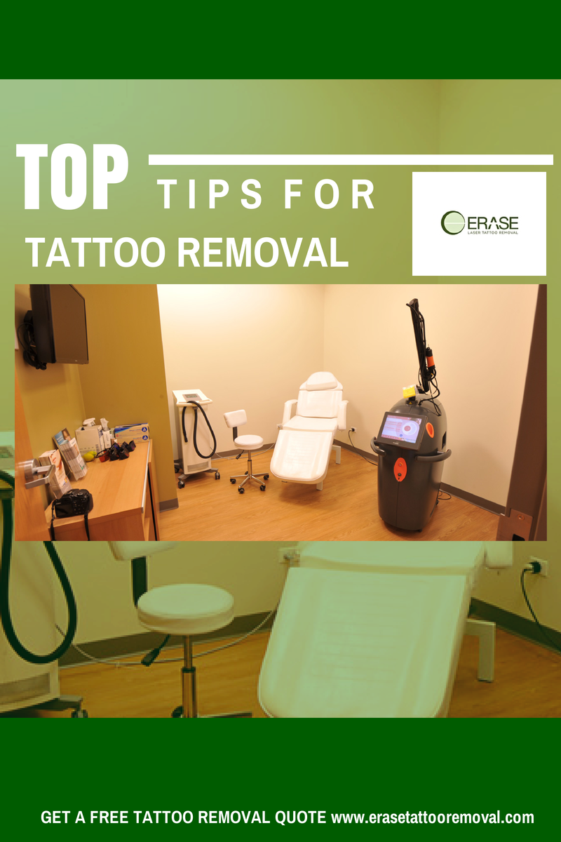 Erase Tattoo Removal August 2014