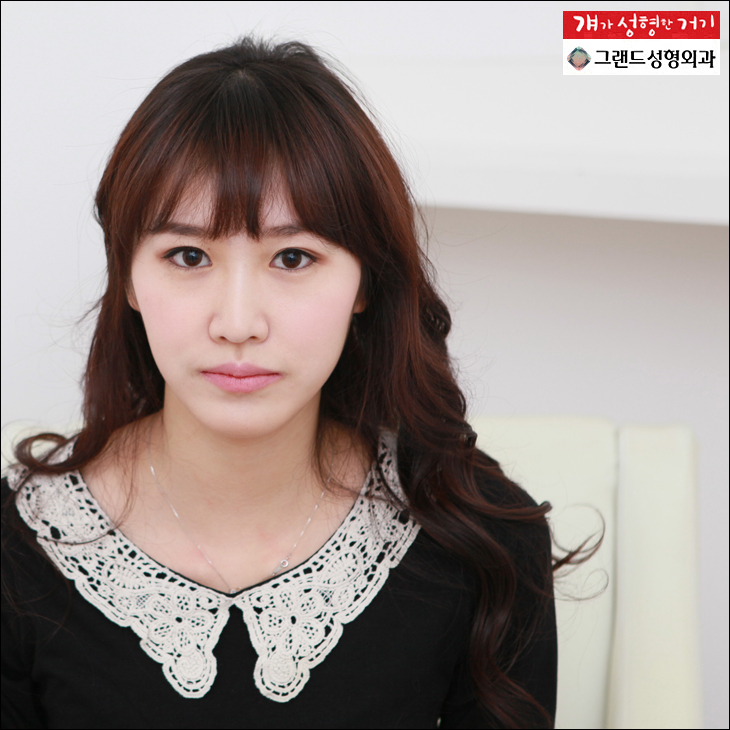 grand plastic surgery korea An asymmetrical Face Correction at Grand!
