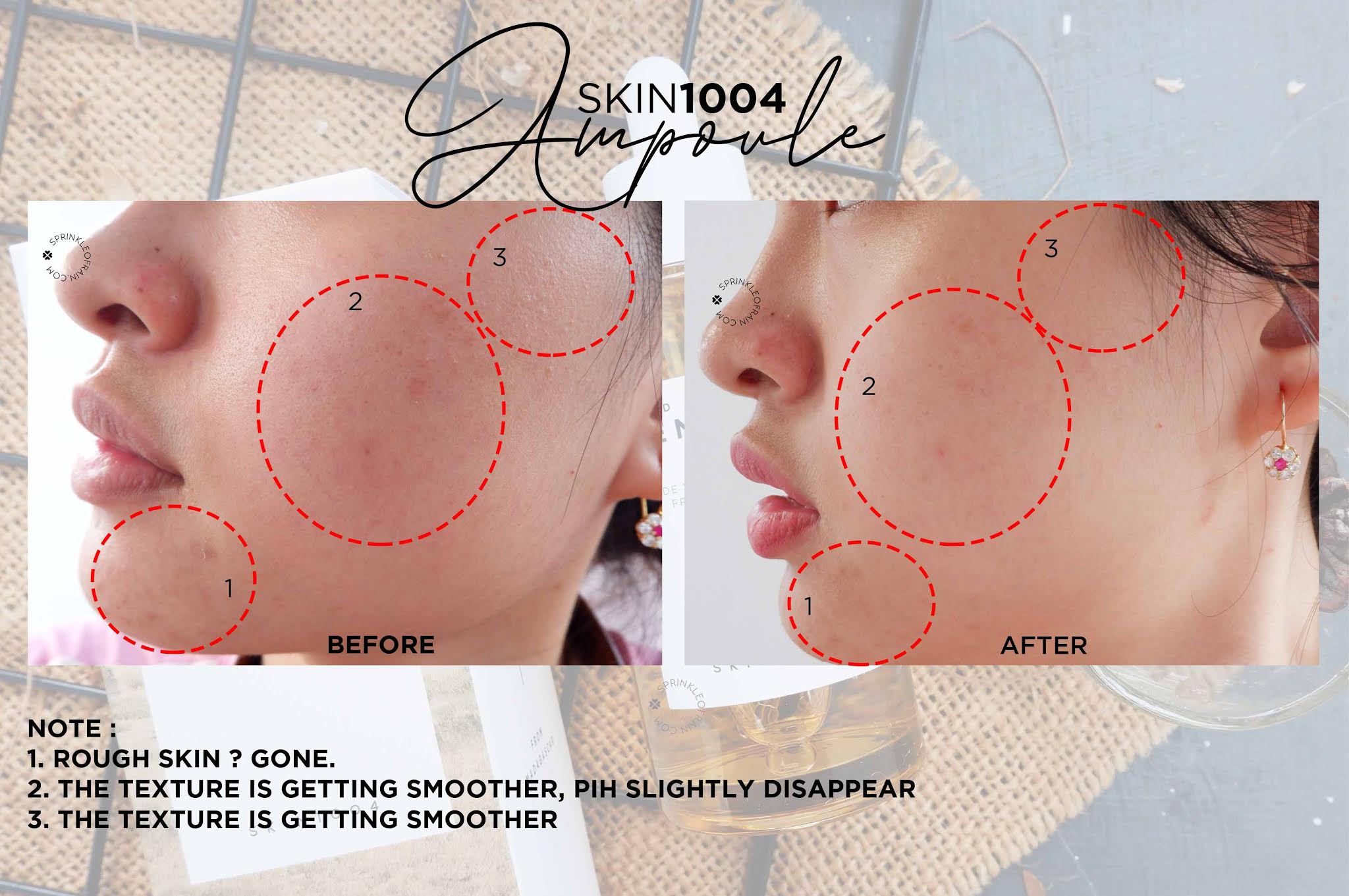 Tinh chất rau má trị mụn Skin1004 Madagascar Centella Ampoule