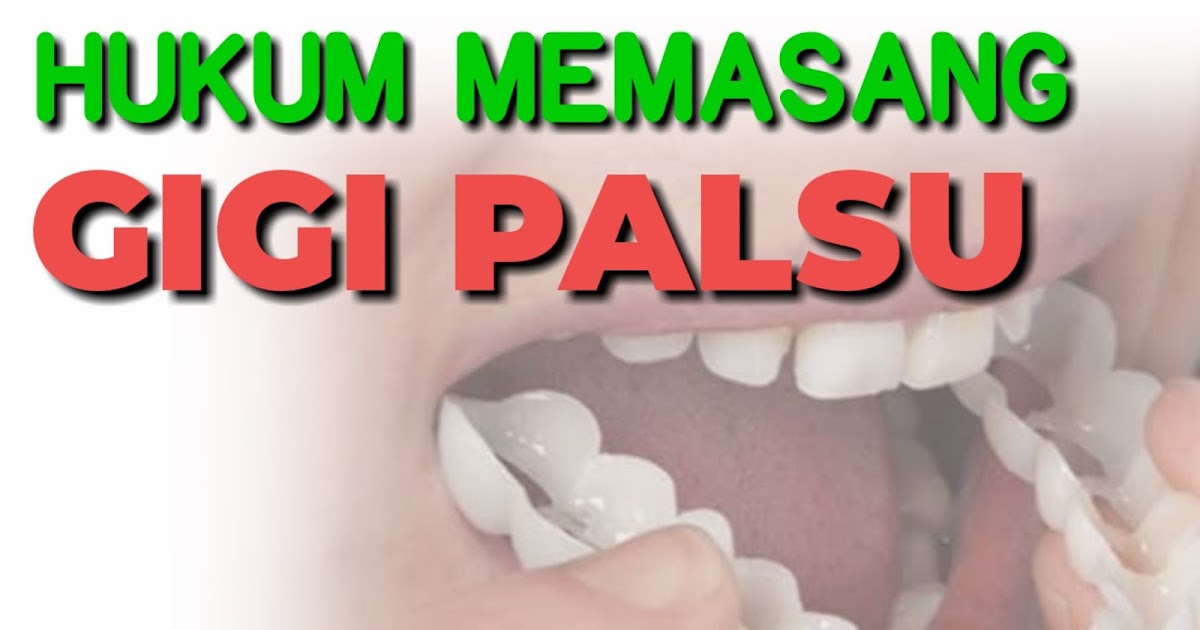 Hukum Memakai Gigi Palsu Menurut Islam Yang Musti Kamu