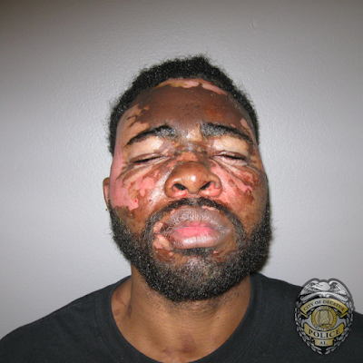 Mujer en Alabama, Estados Unidos quema con grasa caliente cara de agresor