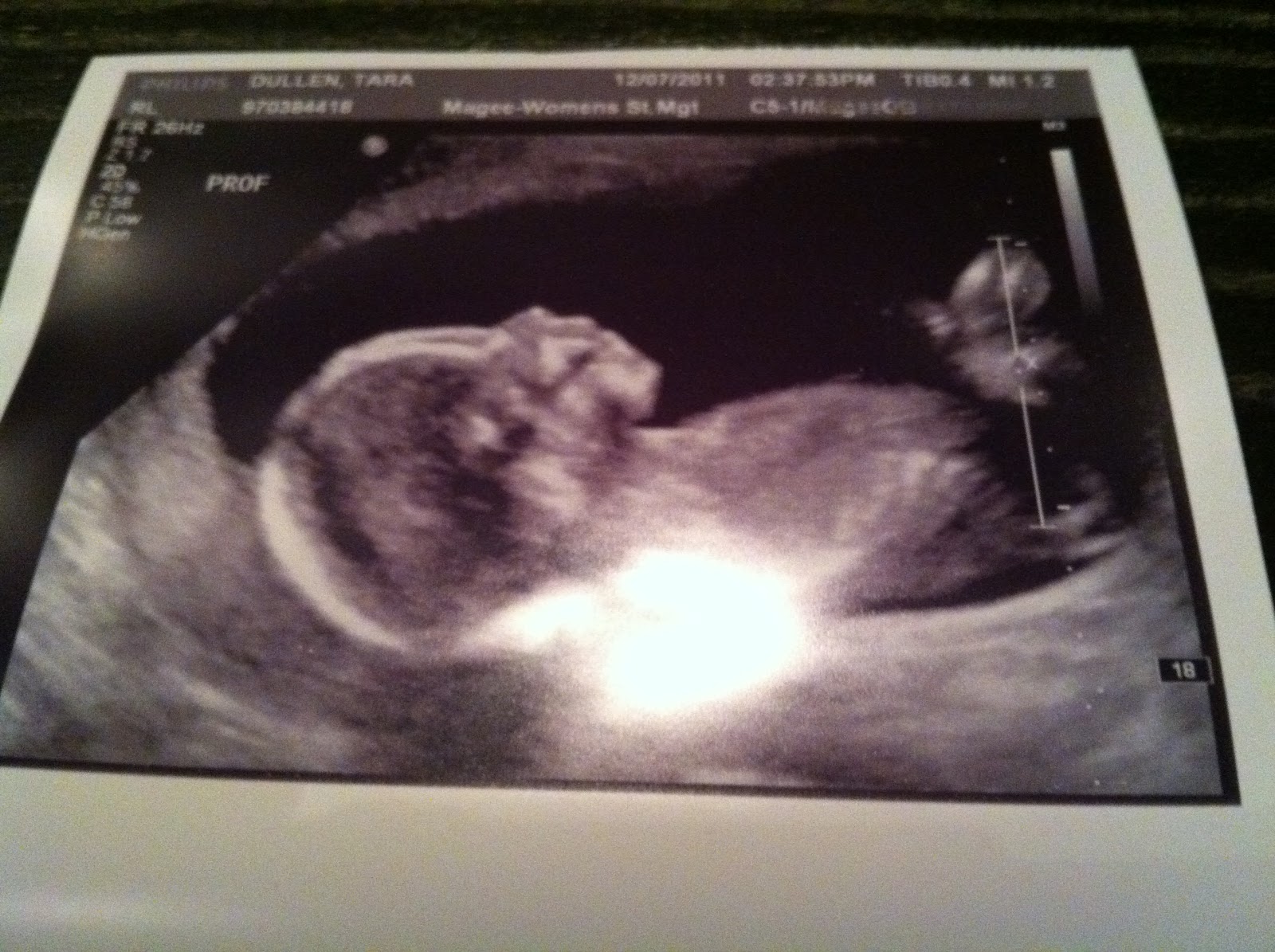 little dullen baby
