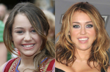 Told You Today: Miley Cyrus Teeth, Pictures Update