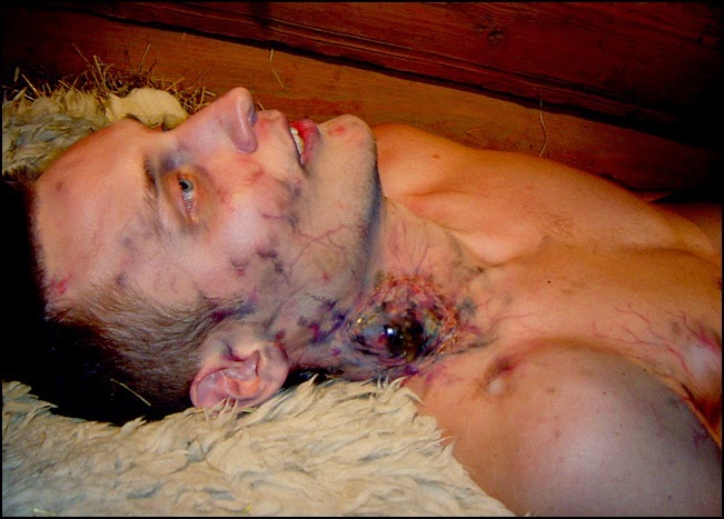 Horrible Diseases On Planet Bubonic Plague