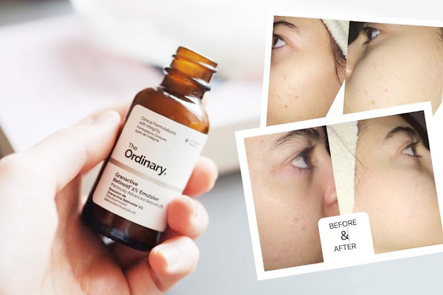 Serum The Ordinary Retinol