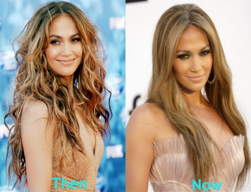 Jennifer Lopez Plastic Surgery Jennifer Lopez Plastic Surgery