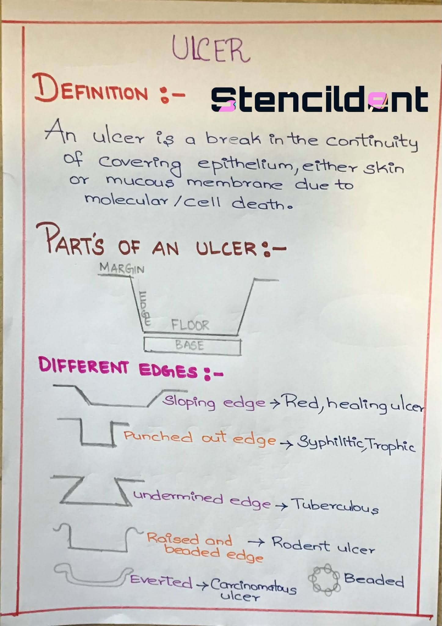 Definition and Classification of Ulcer