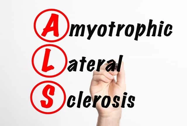 Tindakan Keperawatan Pada Amyotropic Lateral Sklerosis (ALS)