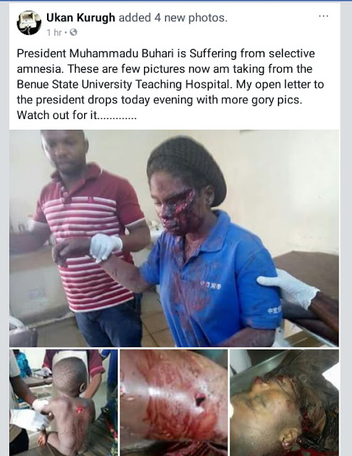 Photos: Many feared dead, scores injured as suspected Fulani herdsmen attack Benue community