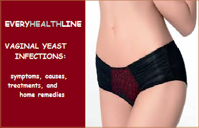 Vaginal Yeast Infection: Symptoms, Causes, Treatment and Prevention