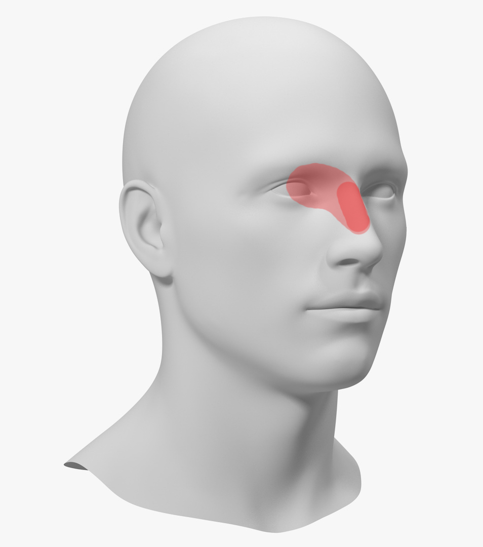 Nasal Bridge Pain (Charlin's Neuralgia) Fauquier ENT Blog