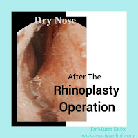 dry nose,rhinoplasty,nasal dryness,