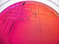 Salmonella-colonies