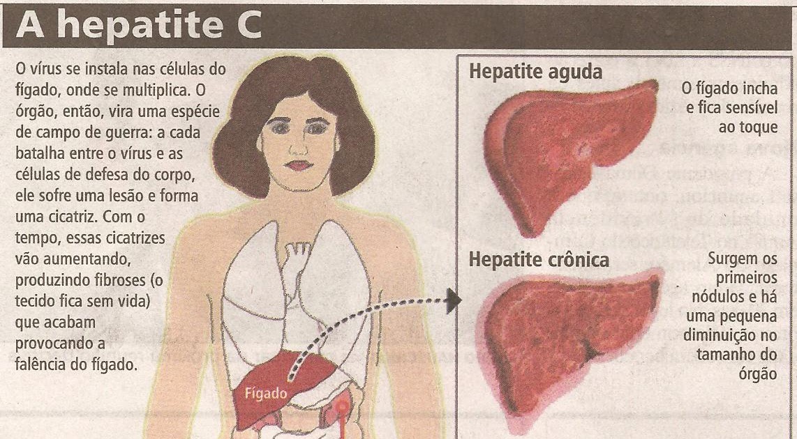 Webpalestra Hepatite C Diagnóstico e tratamento YouTube