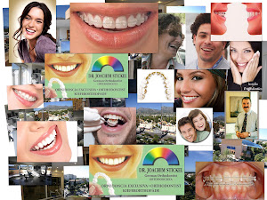 Ortodoncia Arco ideal Collage - Dr. Joachim Stickel - Marbella