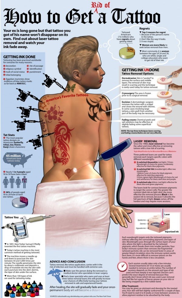 How to Get Rid of a Tattoo #infographic
