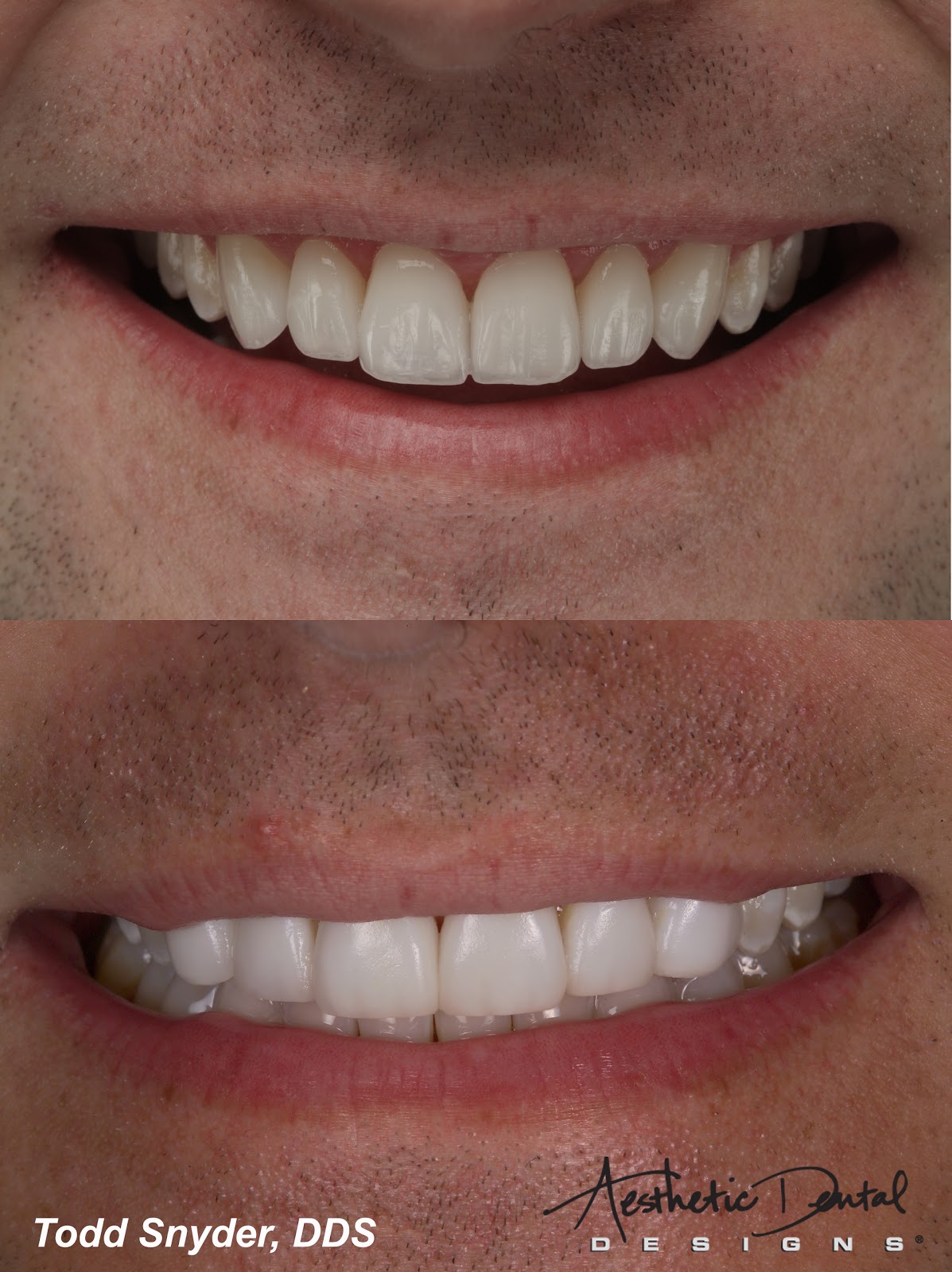 Aesthetic Dental Designs