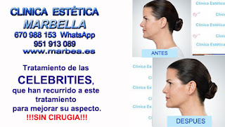Bioplastia mandibular en Marbella En la Clinica Estética Marbella disponemos de los mejores profesionales en medicina