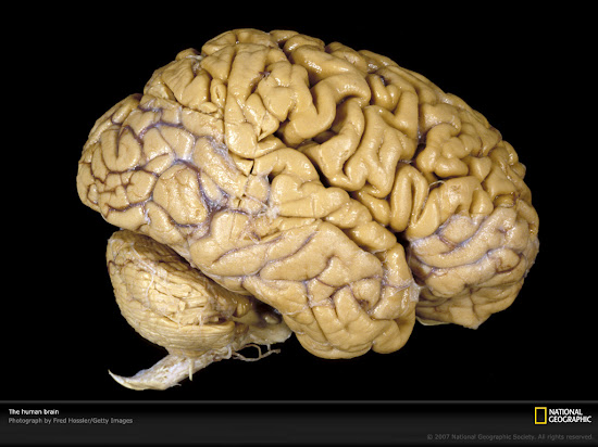 Que significa soñar con cerebro