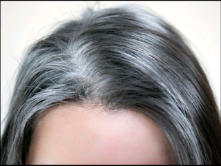 How To Remove White Hair Naturally