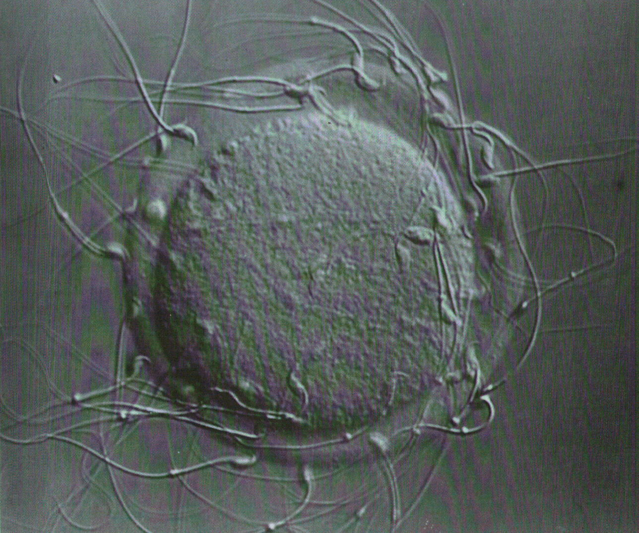 Enroque de ciencia Esperma y espermatozoides