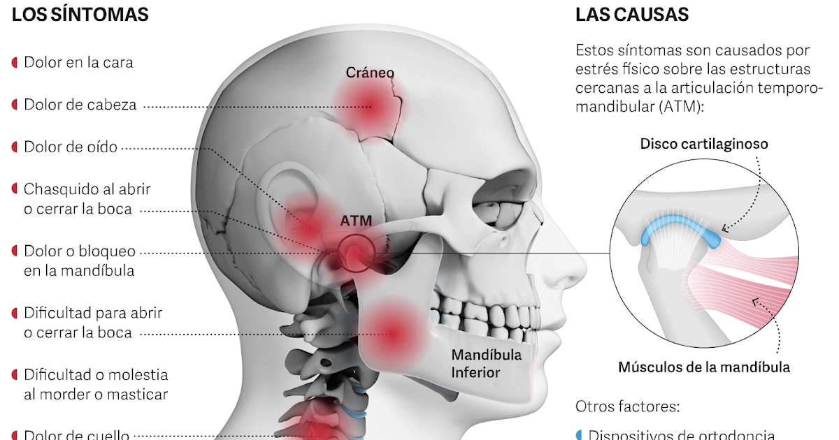 imaxeDxT ATM articulación temporomandibular imaxeDxT ATM articulación temporomandibular