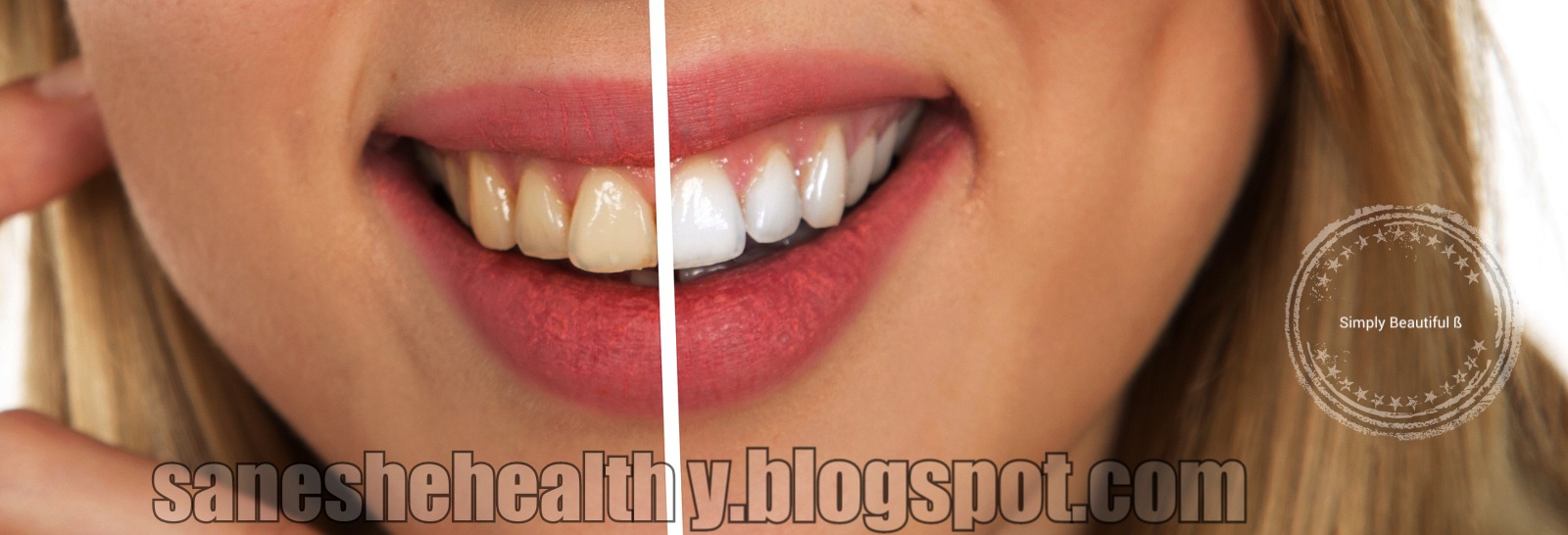 Health blog Teeth whitening trick by dentist.