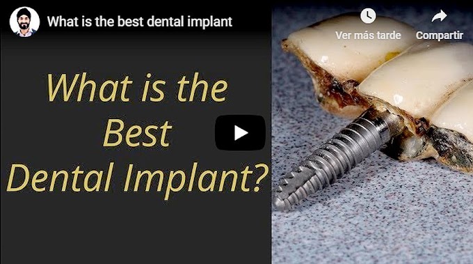 IMPLANTOLOGY: What is the best dental implant - Dr Gurs Sehmi