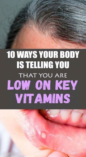 10 Ways Your Body Is Telling You That You Are Low on Key Vitamins