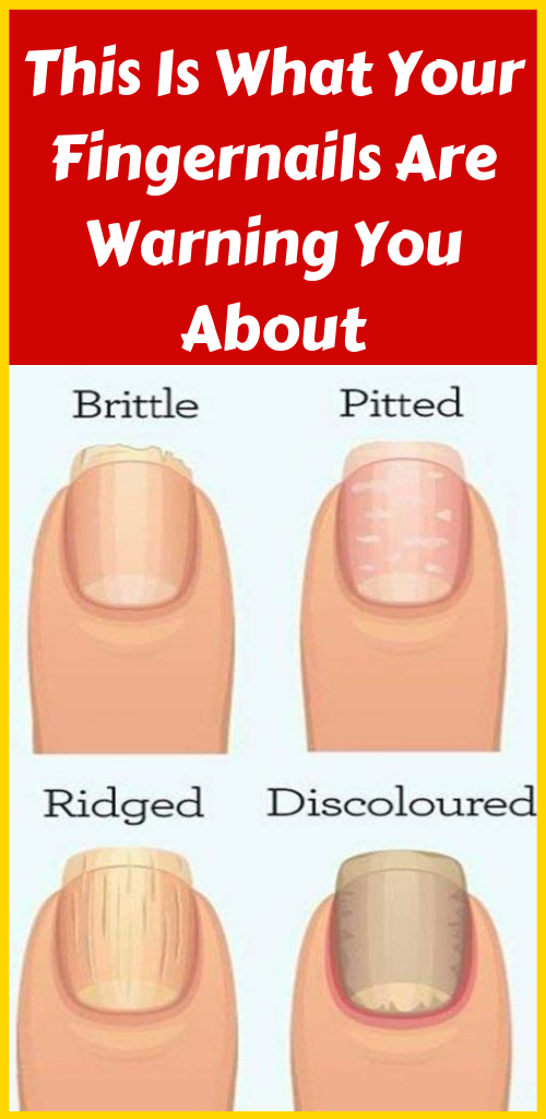 Let Start Slim Today This Is What Your Fingernails Are Warning You