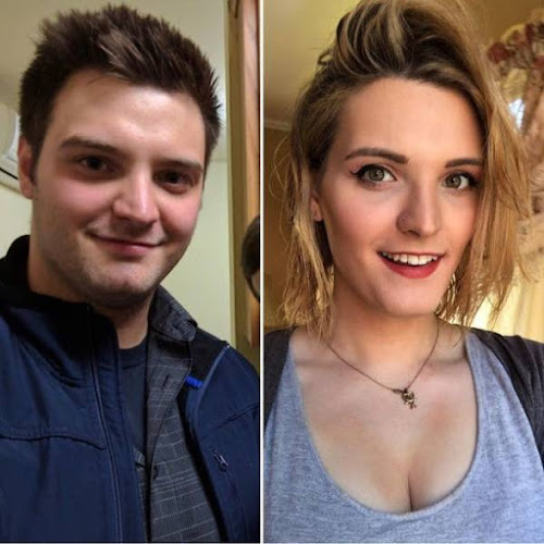 Gender Change Before and After Surgery Sex change Operation Amazing