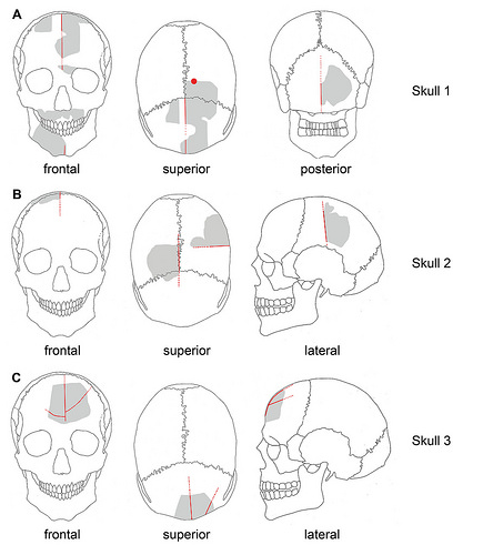 Göbekli Tepe: un culte du crâne du néolithique révélé par les chercheurs