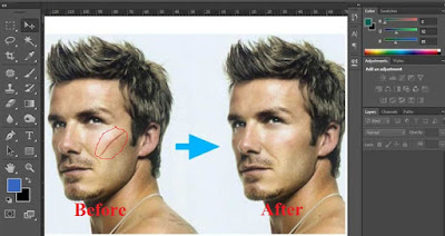 Patch Tool & Spot Healing Brush Photoshop Tool Learn In Hindi Patch Tool Example Images