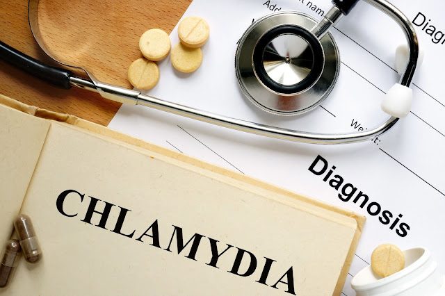 same-day-std-testing-treatment-why-you-must-get-tested-for-chlamydia