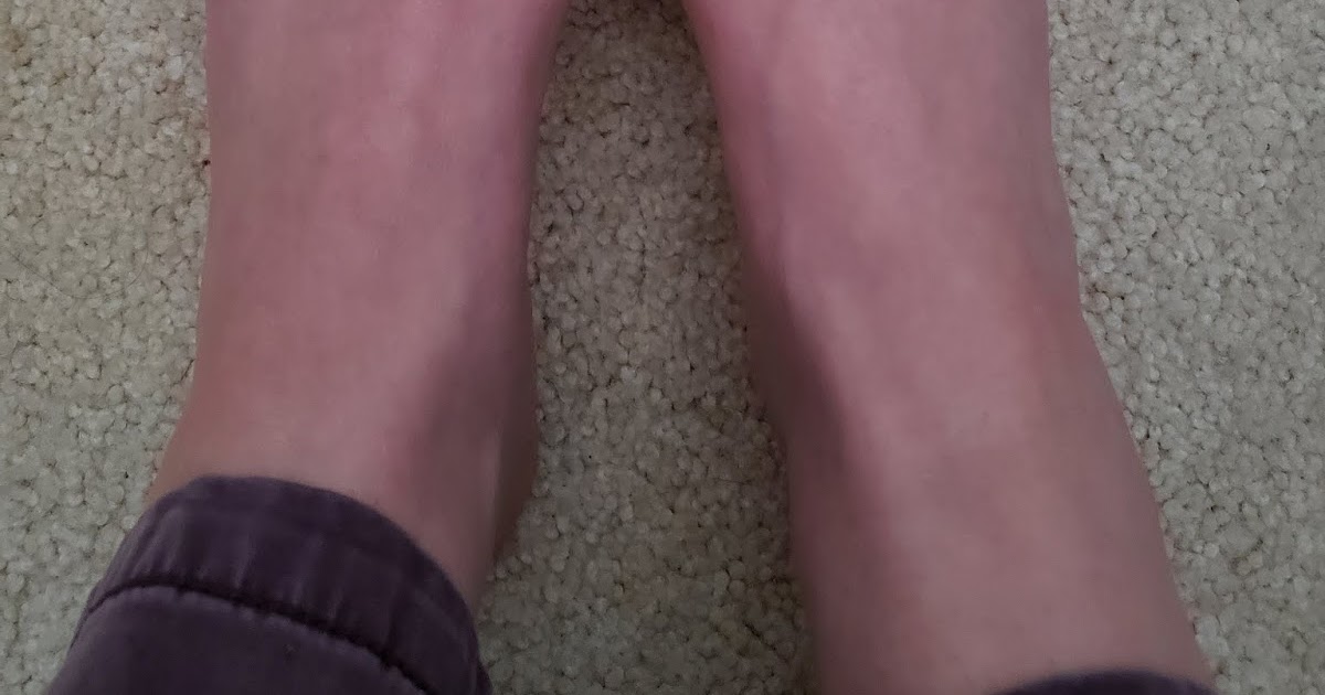 Kindling Health Blood Pooling!