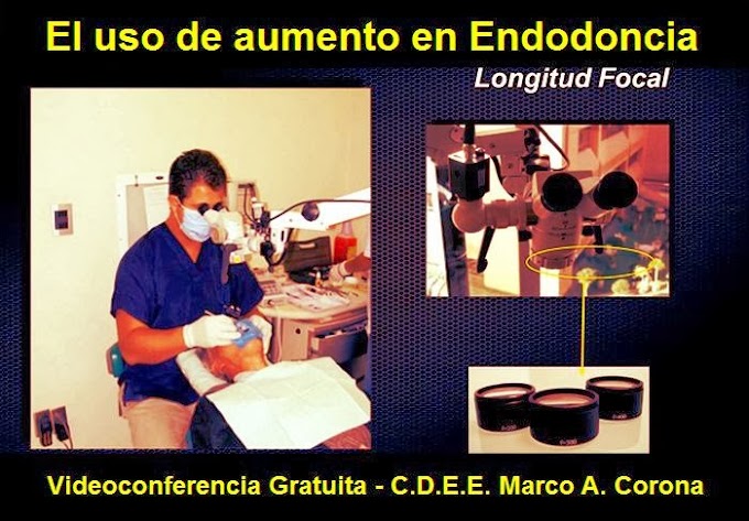 VIDEOCONFERENCIA: El uso de aumento en Endodoncia - C.D.E.E. Marco A. Corona