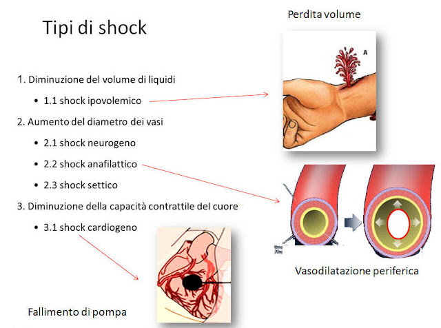 Lo Stato Di Shock Si Manifesta Bushcraft e medicina: Shock, tipi e fisiopatologia