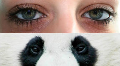 Cara Ampuh Menghilangkan Mata Panda Secara Cepat dan Alami