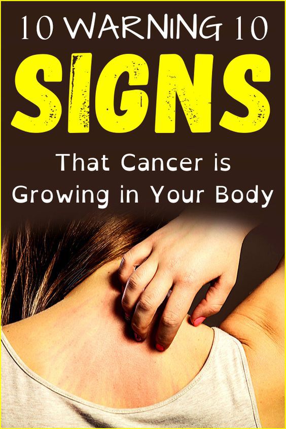 10 Warning Signs That Cancer Is Growing In Your Body