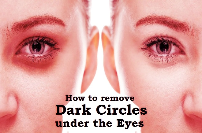 How to Get Rid of Dark Circles Under Eyes - Tiege Hanley