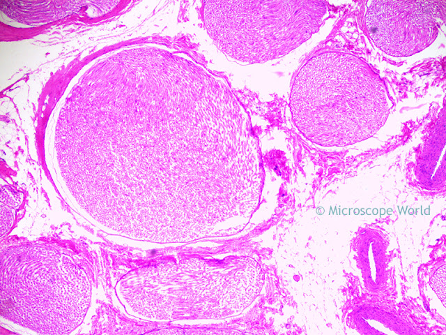 Microscopy image of artery, vein and nerve cross section under the microscope at 40x.