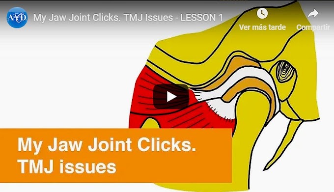 TMJ: My Jaw Joint Clicks - AAD