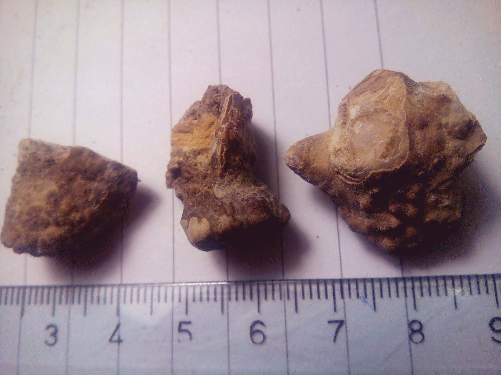 Kidney stones analysis: Dangerous In Kidney Learn This And Save Your Self