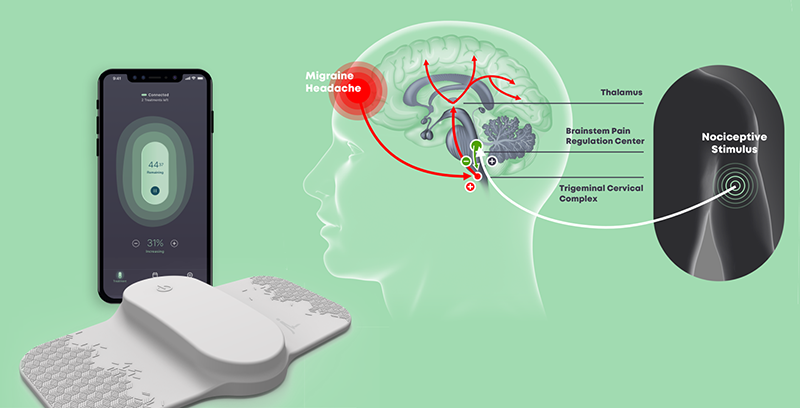 устройство для лечения мигрени | Лучшие изобретения 2019 на Стартап Ньюс