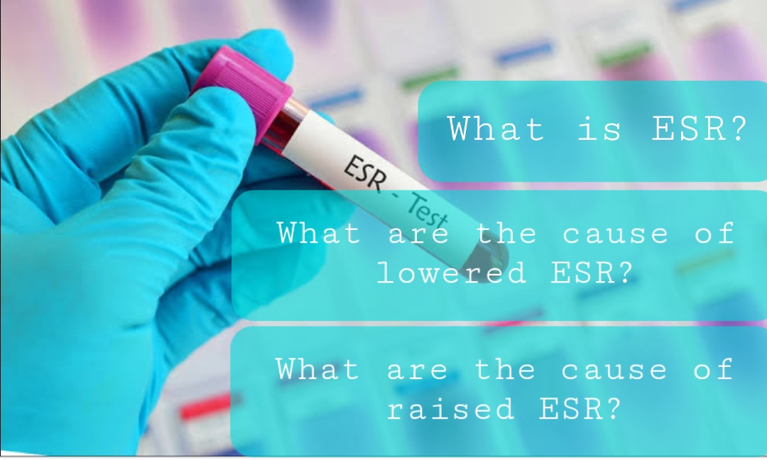 Why Is The ESR Rate In The Blood Rise Or Less? Doctors Gang