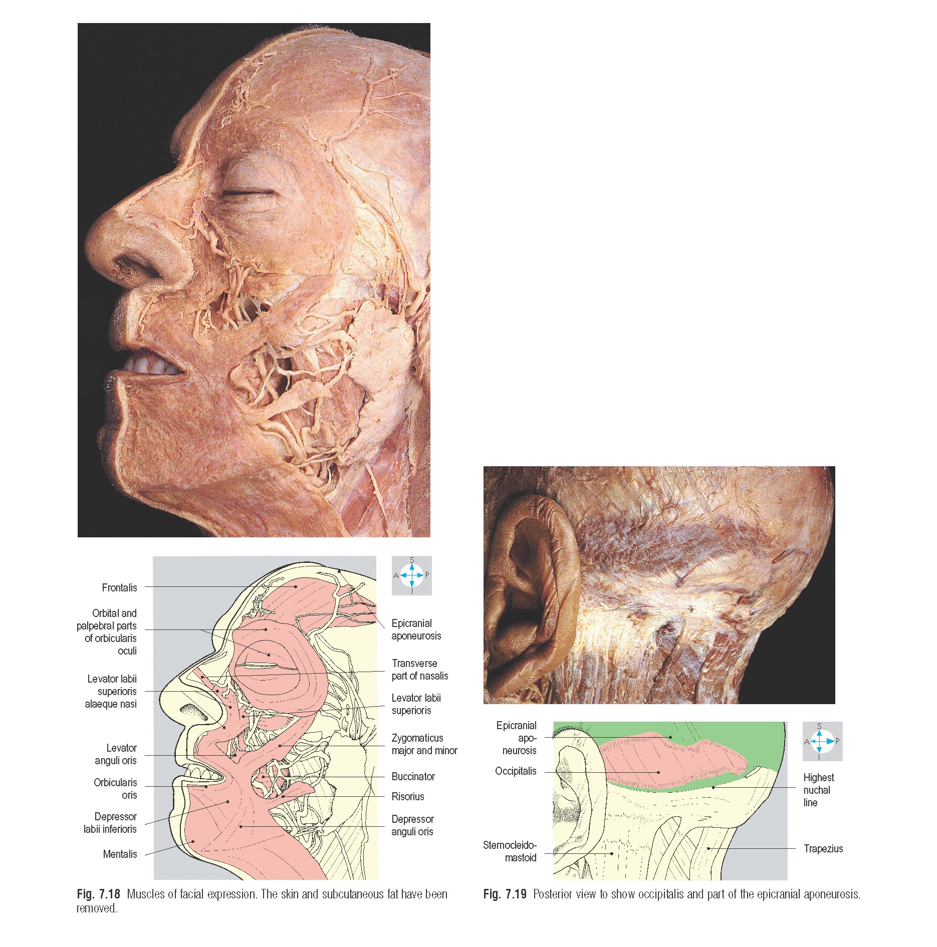 Muscles of facial expression. The skin and subcutaneous fat have been removed.