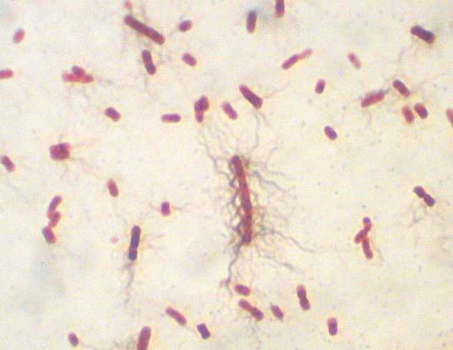 non lactose fermenting gram negative rods treatment non lactose fermenting gram negative rods treatment