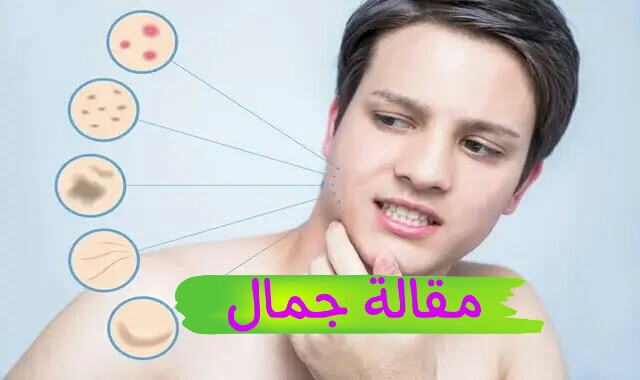 طرق سهلة للعناية ببشرة الرجال في فصل الصيف طرق سهلة للعناية ببشرة الرجال في فصل الصيف