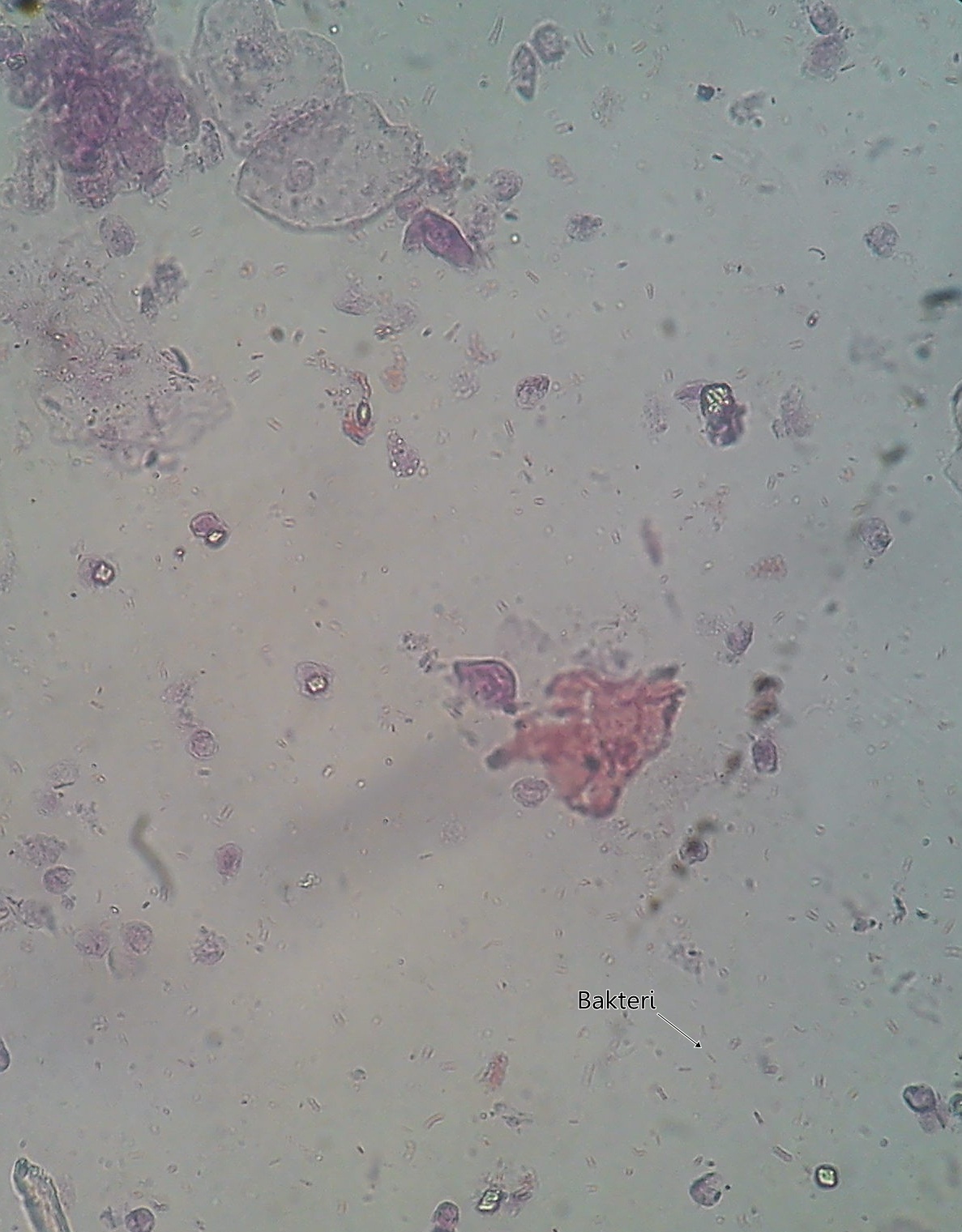 Sedimen Urine (Stainning) | Analis Kesehatan