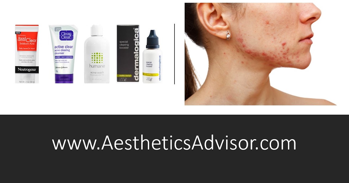 Best Benzoyl Peroxide Acne Treatments in Malaysia 2021 Which One